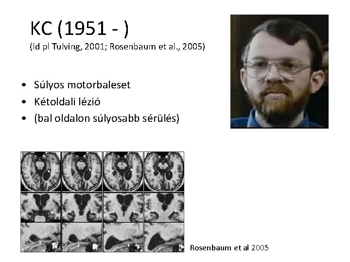 KC (1951 - ) (ld pl Tulving, 2001; Rosenbaum et al. , 2005) •