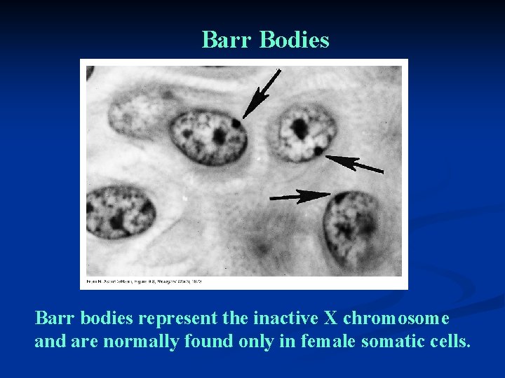 Barr Bodies Barr bodies represent the inactive X chromosome and are normally found only