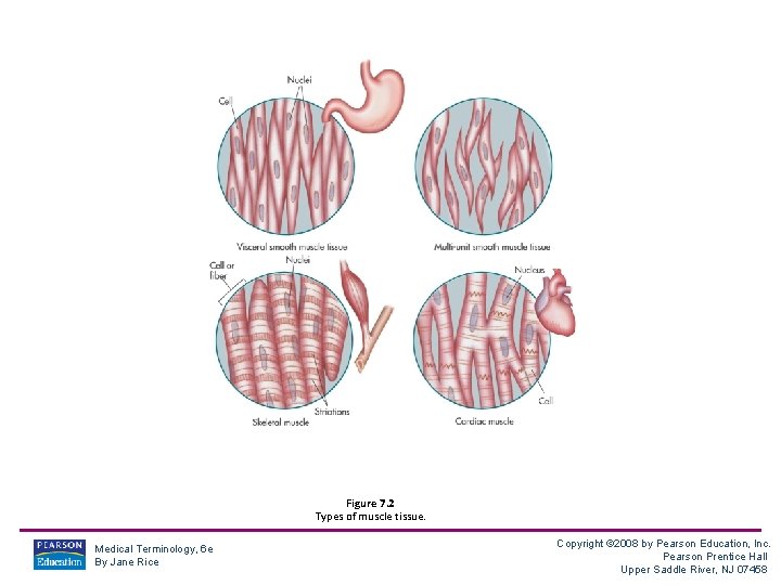 Figure 7. 2 Types of muscle tissue. Medical Terminology, 6 e By Jane Rice