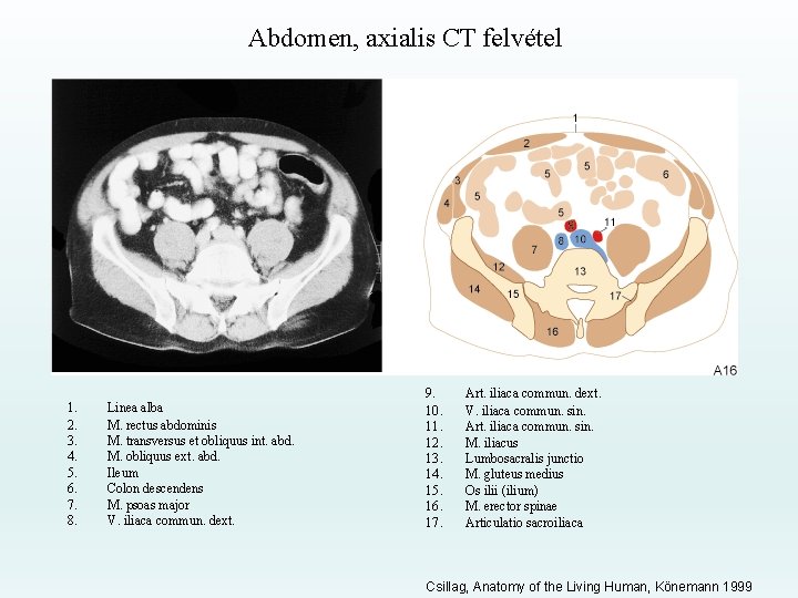 Abdomen, axialis CT felvétel 1. 2. 3. 4. 5. 6. 7. 8. Linea alba