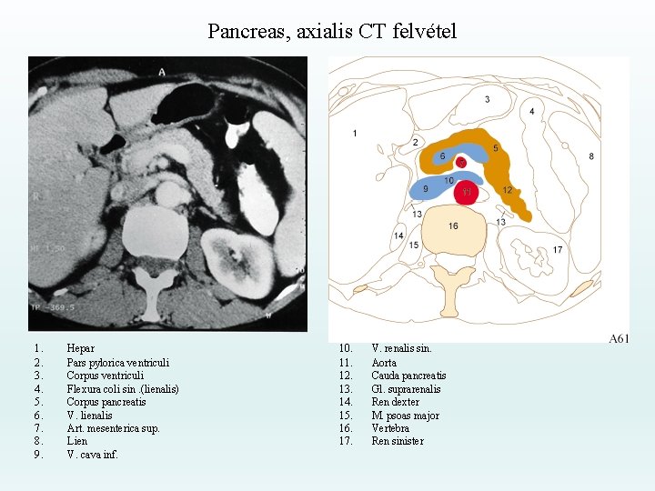 Pancreas, axialis CT felvétel 1. 2. 3. 4. 5. 6. 7. 8. 9. Hepar