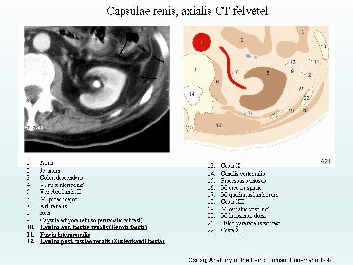 Capsulae renis, axialis CT felvétel 1. 2. 3. 4. 5. 6. 7. 8. 9.