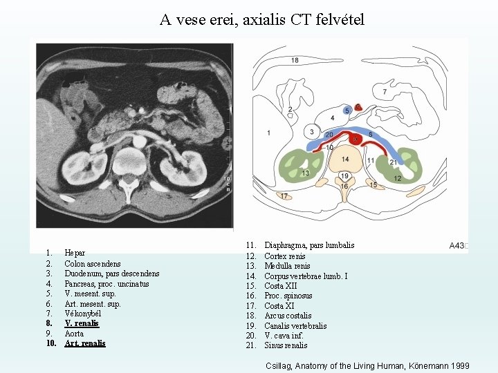 A vese erei, axialis CT felvétel 1. 2. 3. 4. 5. 6. 7. 8.