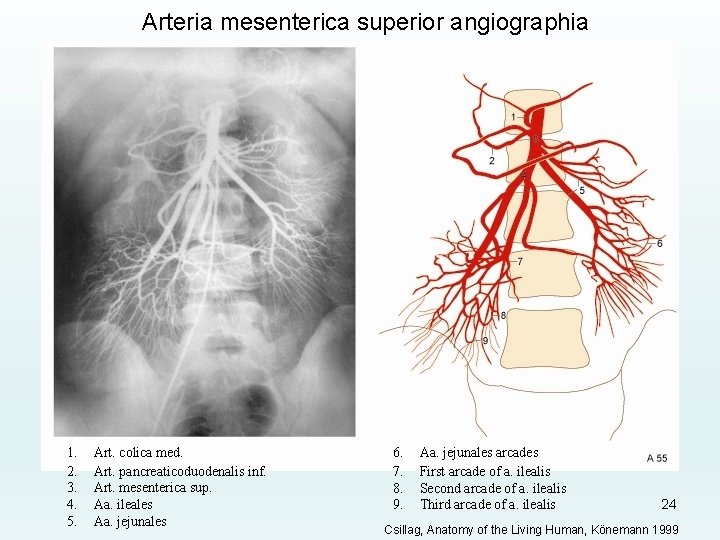 Arteria mesenterica superior angiographia 1. 2. 3. 4. 5. Art. colica med. Art. pancreaticoduodenalis