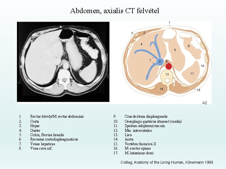 Abdomen, axialis CT felvétel 1. 2. 3. 4. 5. 6. 7. 8. Rectus hüvely/M.