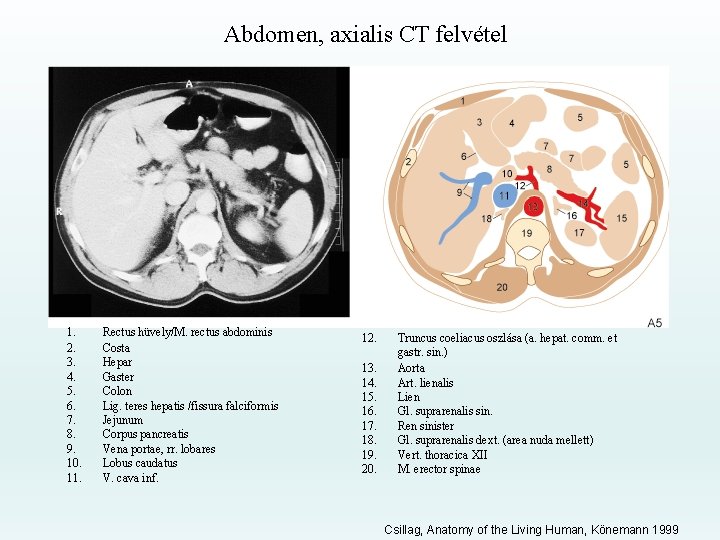 Abdomen, axialis CT felvétel 1. 2. 3. 4. 5. 6. 7. 8. 9. 10.