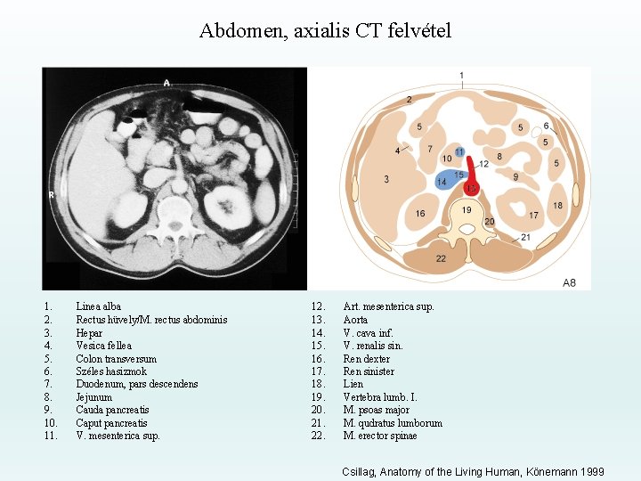 Abdomen, axialis CT felvétel 1. 2. 3. 4. 5. 6. 7. 8. 9. 10.