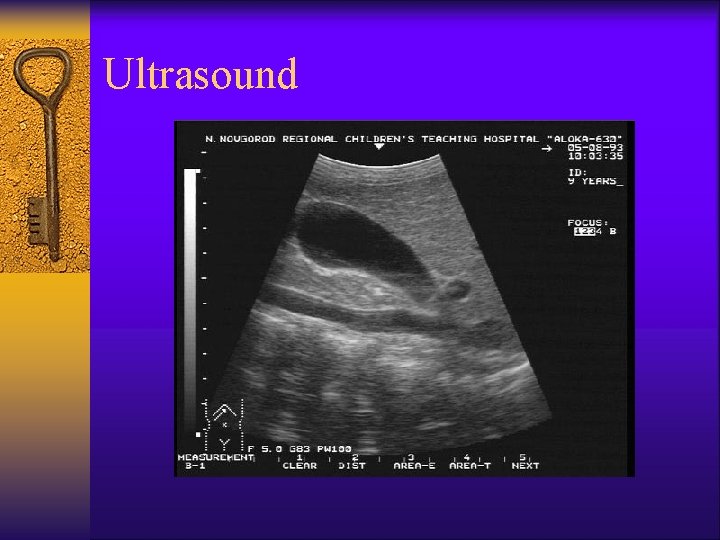 Ultrasound 