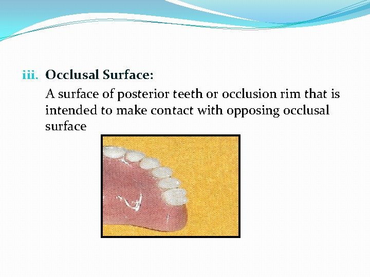 iii. Occlusal Surface: A surface of posterior teeth or occlusion rim that is intended