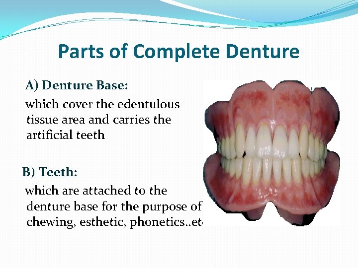 Parts of Complete Denture A) Denture Base: which cover the edentulous tissue area and