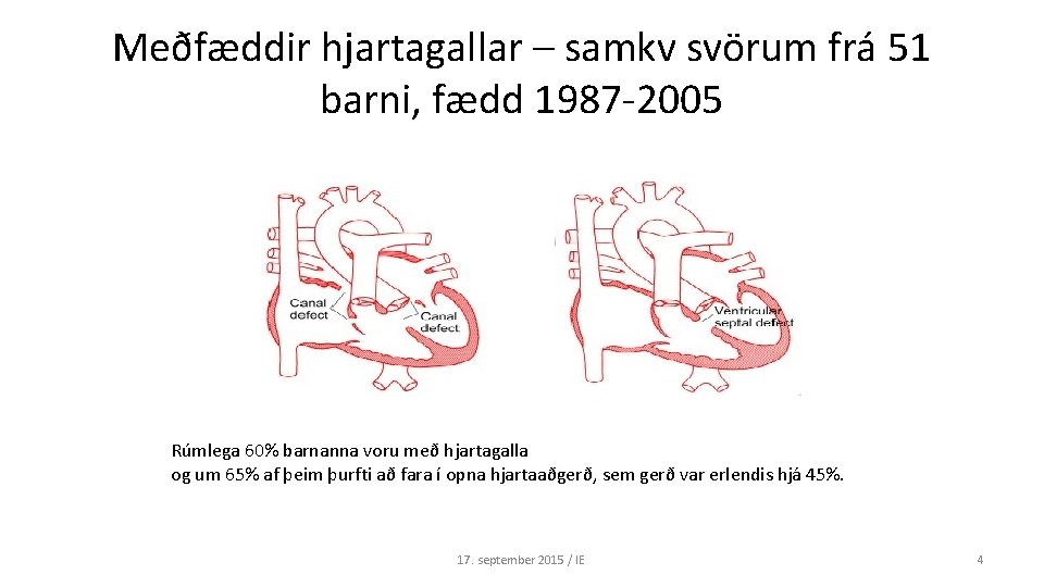 Meðfæddir hjartagallar – samkv svörum frá 51 barni, fædd 1987 -2005 Rúmlega 60% barnanna