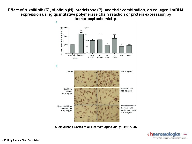 Effect of ruxolitinib (R), nilotinib (N), prednisone (P), and their combination, on collagen I