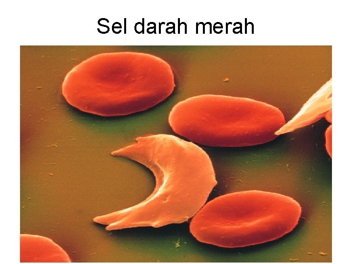 Sel darah merah 