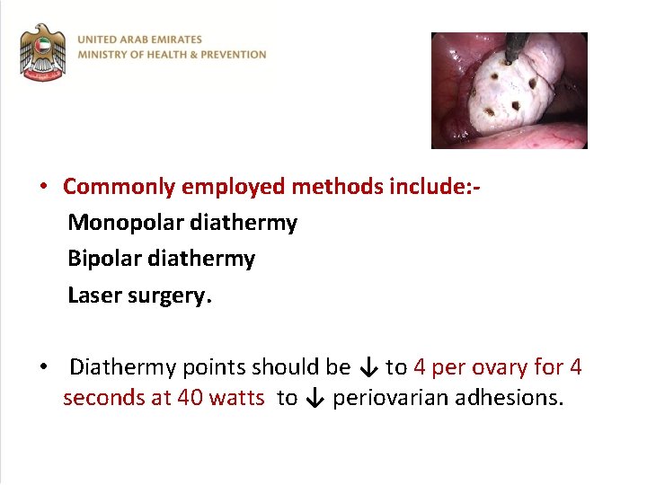  • Commonly employed methods include: Monopolar diathermy Bipolar diathermy Laser surgery. • Diathermy