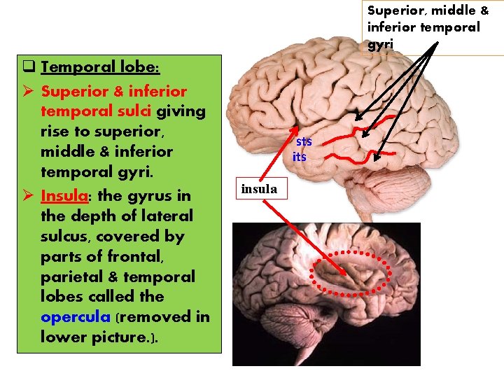 Superior, middle & inferior temporal gyri q Temporal lobe: Ø Superior & inferior temporal