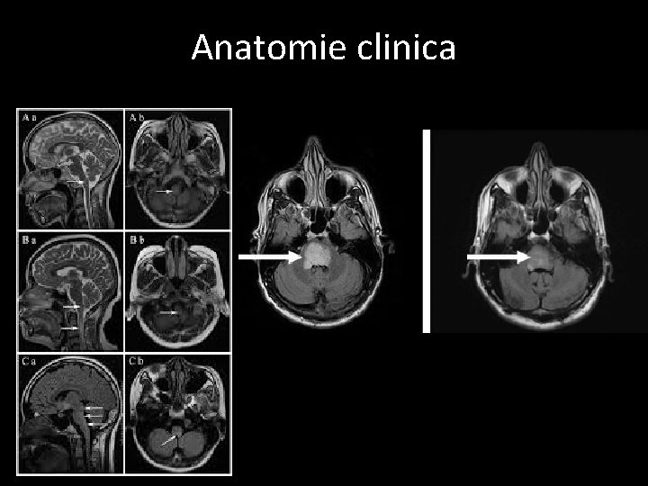 Anatomie clinica 