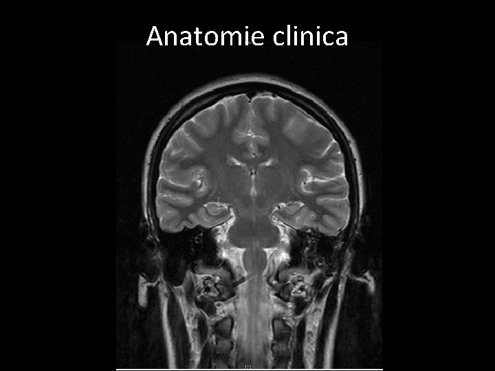 Anatomie clinica 