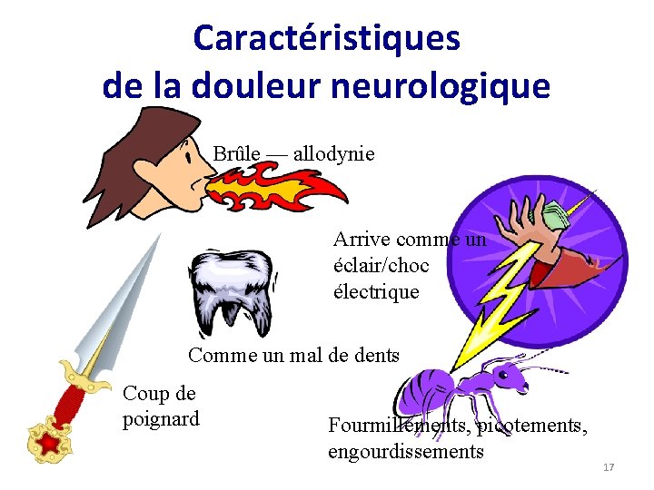 Caractéristiques de la douleur neurologique Brûle — allodynie Arrive comme un éclair/choc électrique Comme