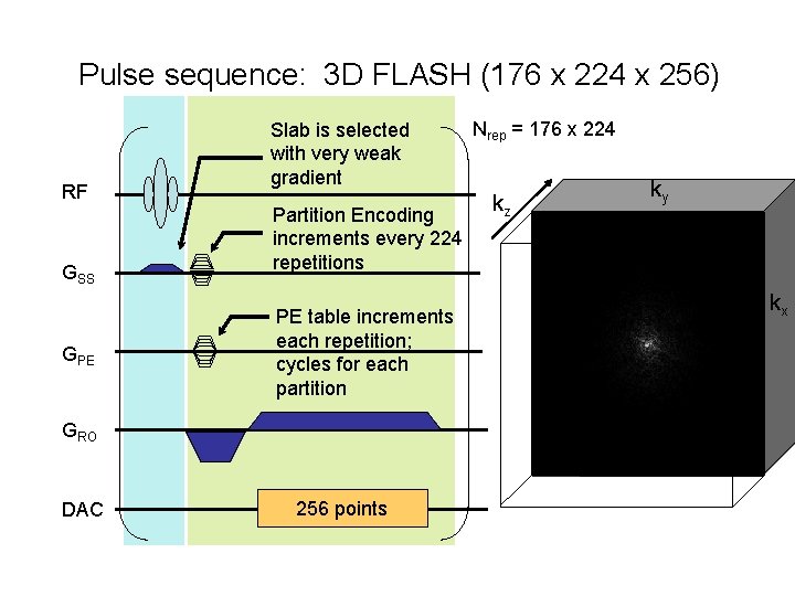 Pulse sequence: 3 D FLASH (176 x 224 x 256) RF GSS GPE Slab