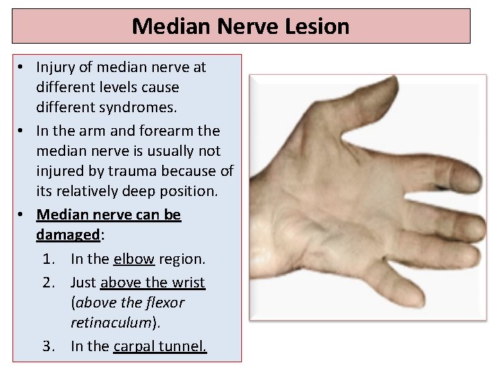 Median Nerve Lesion • Injury of median nerve at different levels cause different syndromes.