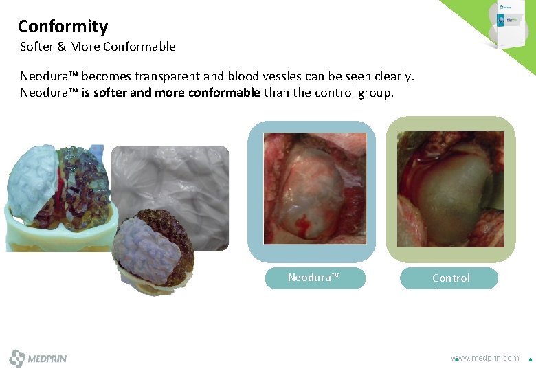 Conformity Softer & More Conformable Neodura™ becomes transparent and blood vessles can be seen