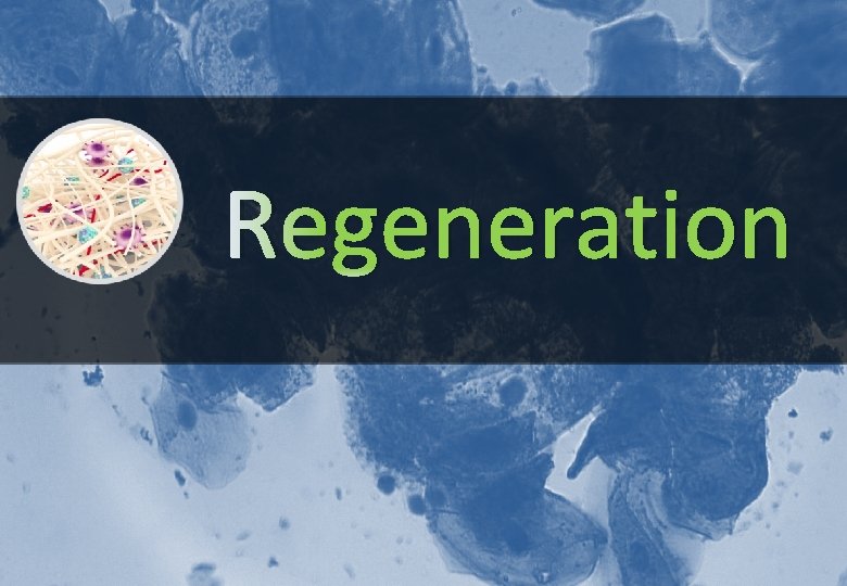 Regeneration www. medprin. com 