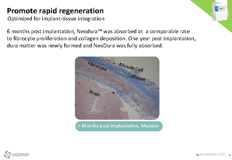 Promote rapid regeneration Optimized for implant-tissue integration 6 months post implantation, Neodura™ was absorbed