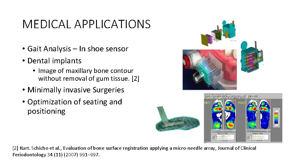 MEDICAL APPLICATIONS • Gait Analysis – In shoe sensor • Dental implants • Image MEDICAL APPLICATIONS • Gait Analysis – In shoe sensor • Dental implants • Image