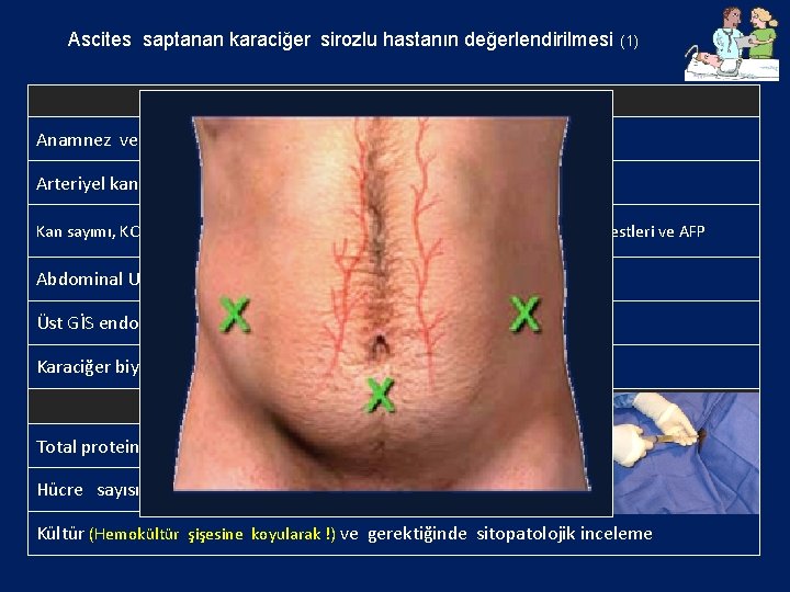 Ascites saptanan karaciğer sirozlu hastanın değerlendirilmesi (1) Genel değerlendirme Anamnez ve beden muayenesi Arteriyel