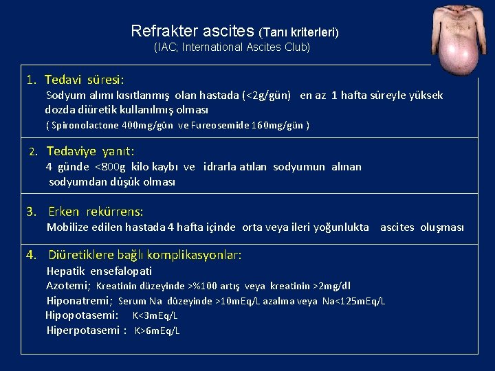 Refrakter ascites (Tanı kriterleri) (IAC; International Ascites Club) 1. Tedavi süresi: Sodyum alımı kısıtlanmış