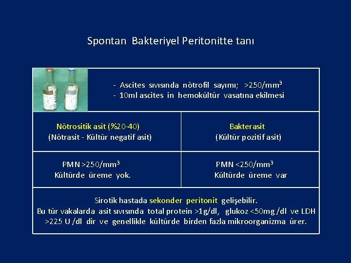 Spontan Bakteriyel Peritonitte tanı - Ascites sıvısında nötrofil sayımı; >250/mm 3 - 10 ml