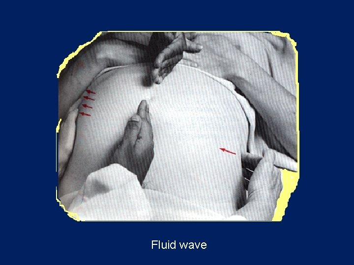 Fluid wave 