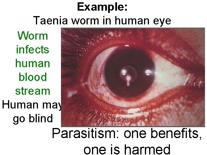 Example: Taenia worm in human eye Worm infects human blood stream Human may go