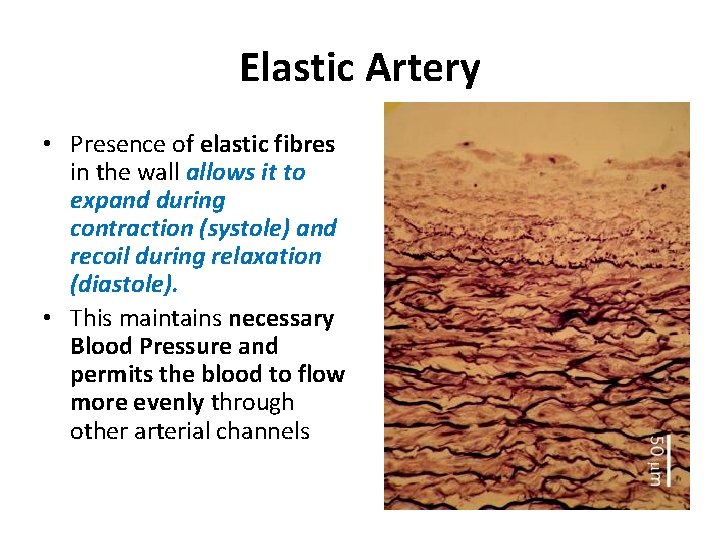Elastic Artery • Presence of elastic fibres in the wall allows it to expand
