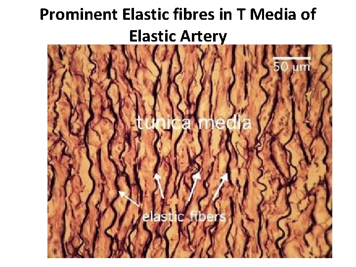 Prominent Elastic fibres in T Media of Elastic Artery 