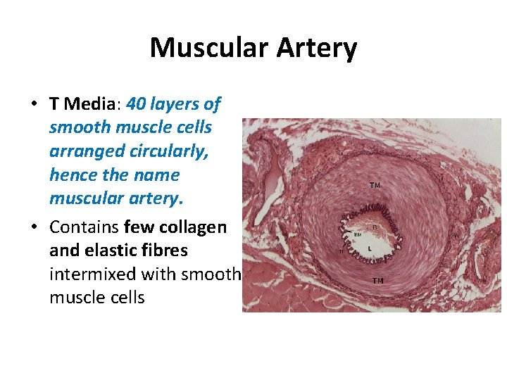 Muscular Artery • T Media: 40 layers of smooth muscle cells arranged circularly, hence
