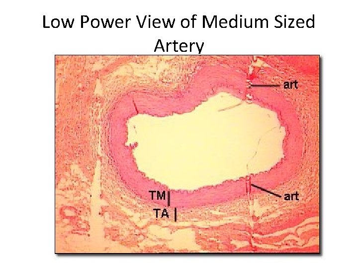 Low Power View of Medium Sized Artery 