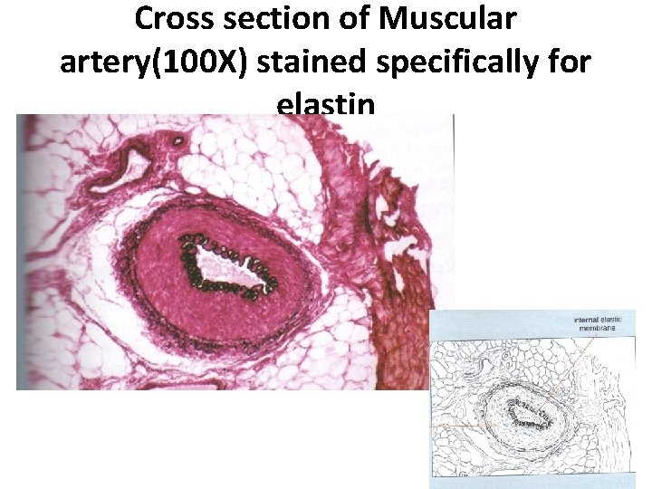 Cross section of Muscular artery(100 X) stained specifically for elastin 