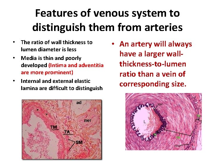 Features of venous system to distinguish them from arteries • The ratio of wall