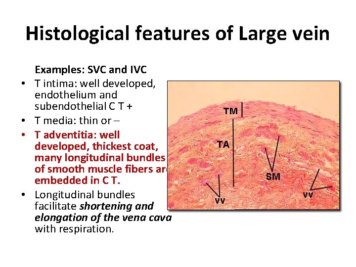 Histological features of Large vein • • Examples: SVC and IVC T intima: well