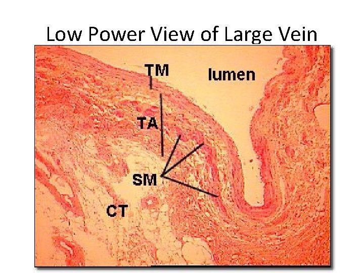 Low Power View of Large Vein 