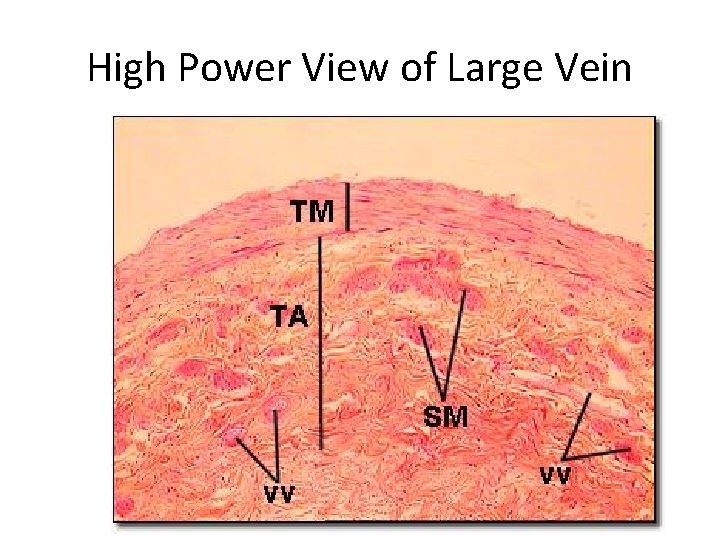 High Power View of Large Vein 
