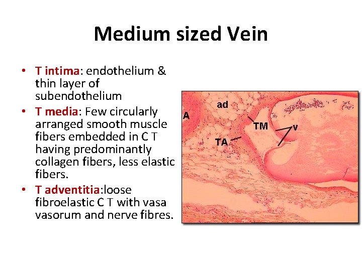 Medium sized Vein • T intima: endothelium & thin layer of subendothelium • T