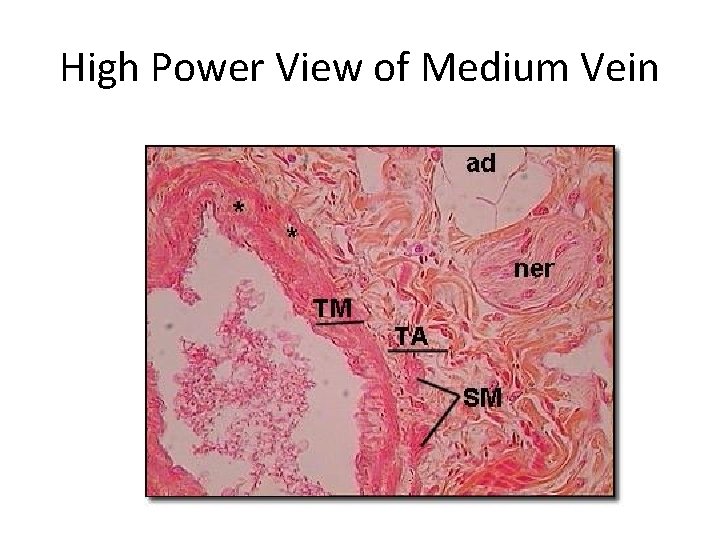 High Power View of Medium Vein 