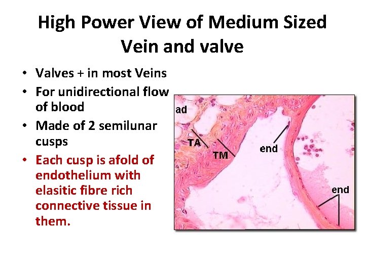 High Power View of Medium Sized Vein and valve • Valves + in most