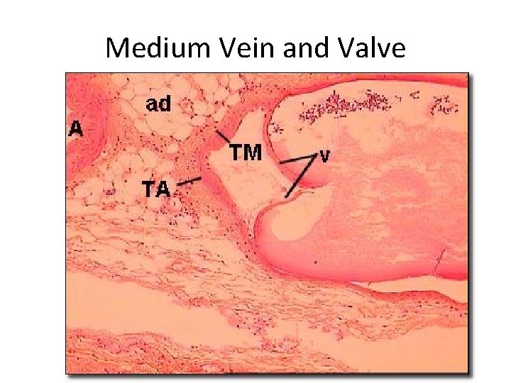 Medium Vein and Valve 