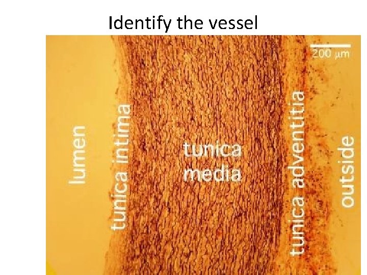 Identify the vessel 