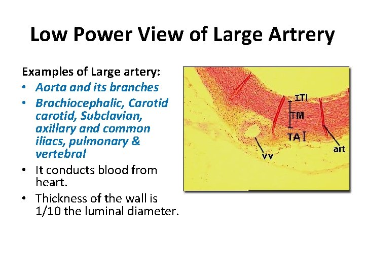 Low Power View of Large Artrery Examples of Large artery: • Aorta and its