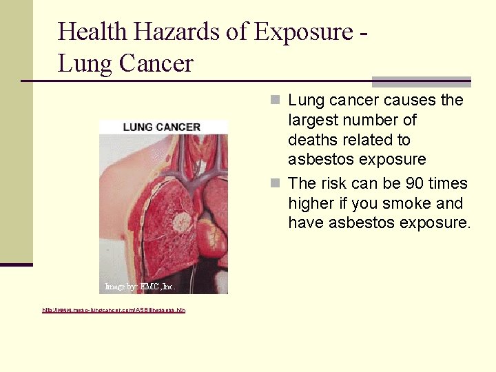 Health Hazards of Exposure Lung Cancer n Lung cancer causes the largest number of