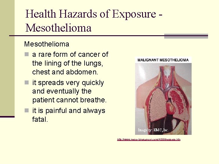 Health Hazards of Exposure Mesothelioma n a rare form of cancer of the lining